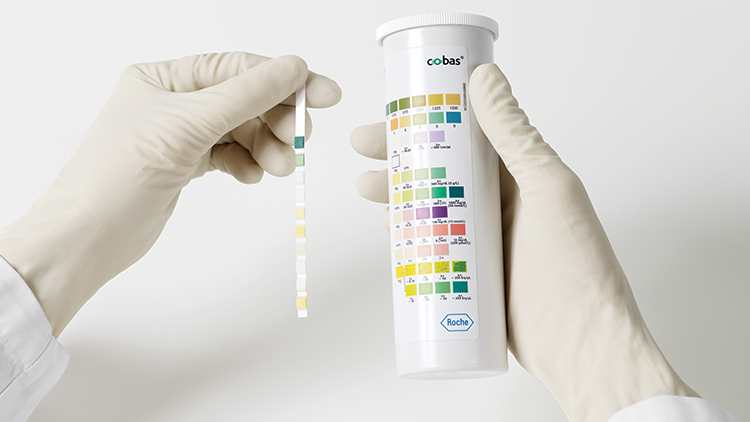 Drogue : Le test de dépistage urinaire en pharmacie dès janvier