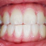 Dents, douleurs dentaires